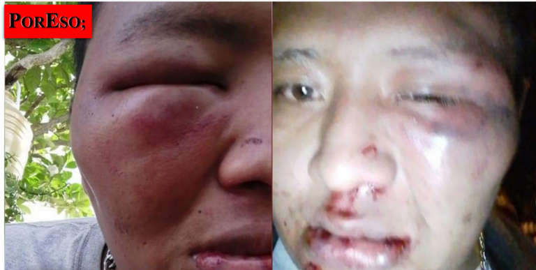 Violento asalto en Sambula