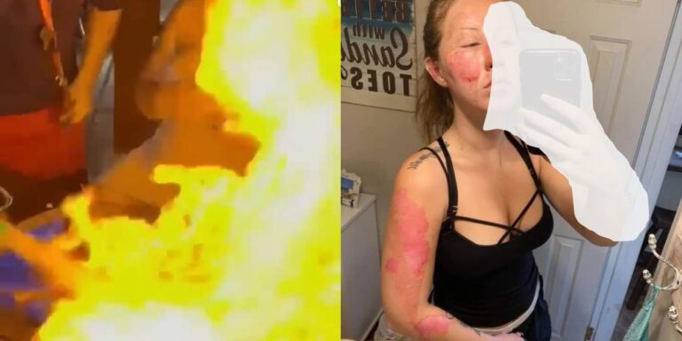 «LAS DE GUANATOS» INCENDIA EL ROSTRO DE UNA TURISTA EN CANCÚN