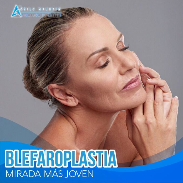 Blefaroplastia