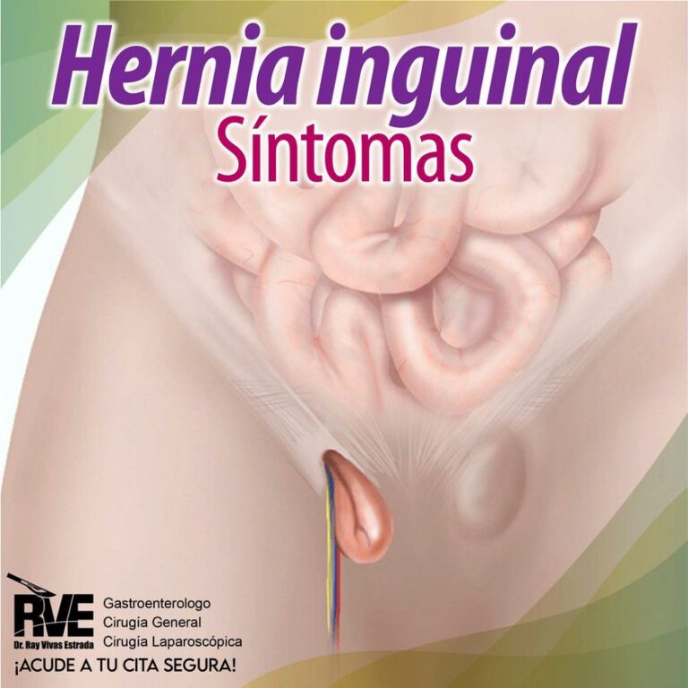 Hernia inguinal