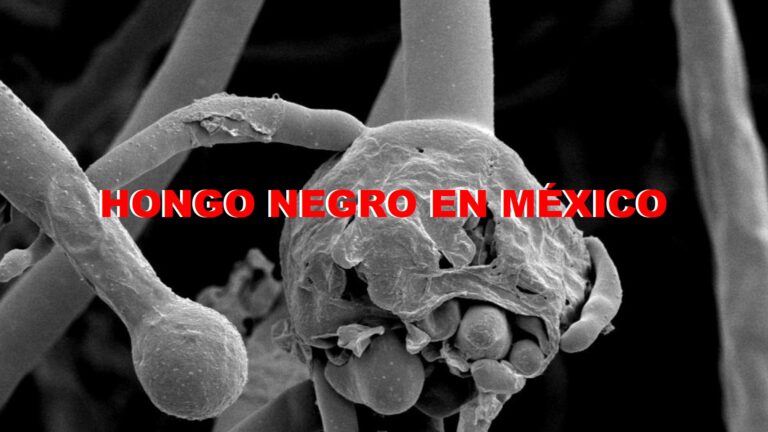 DETECTAN EN MÉXICO PRIMER CASO DE HONGO NEGRO