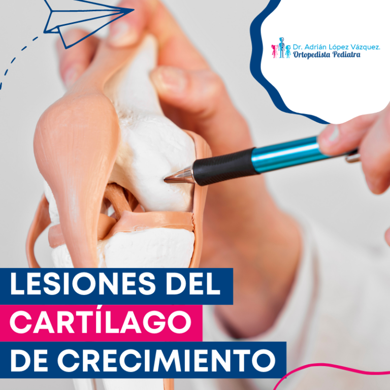 Lesiones del cartílago de crecimiento.