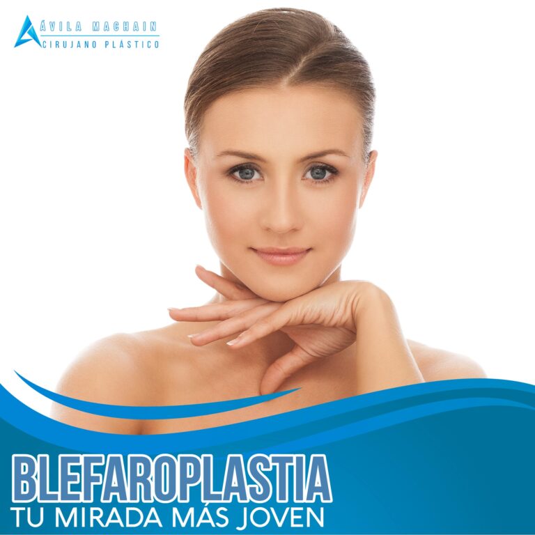 Blefaroplastia