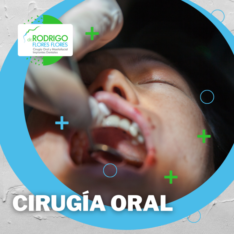 Cirugía Oral