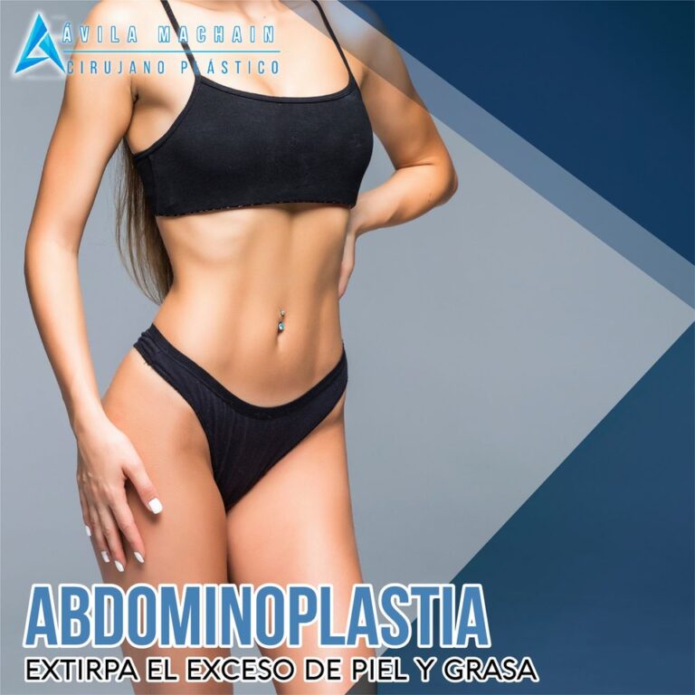 Abdominoplastia