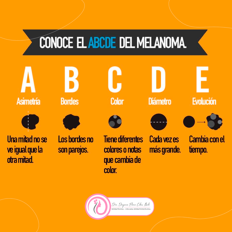 Conoce el ABCDE del melanoma