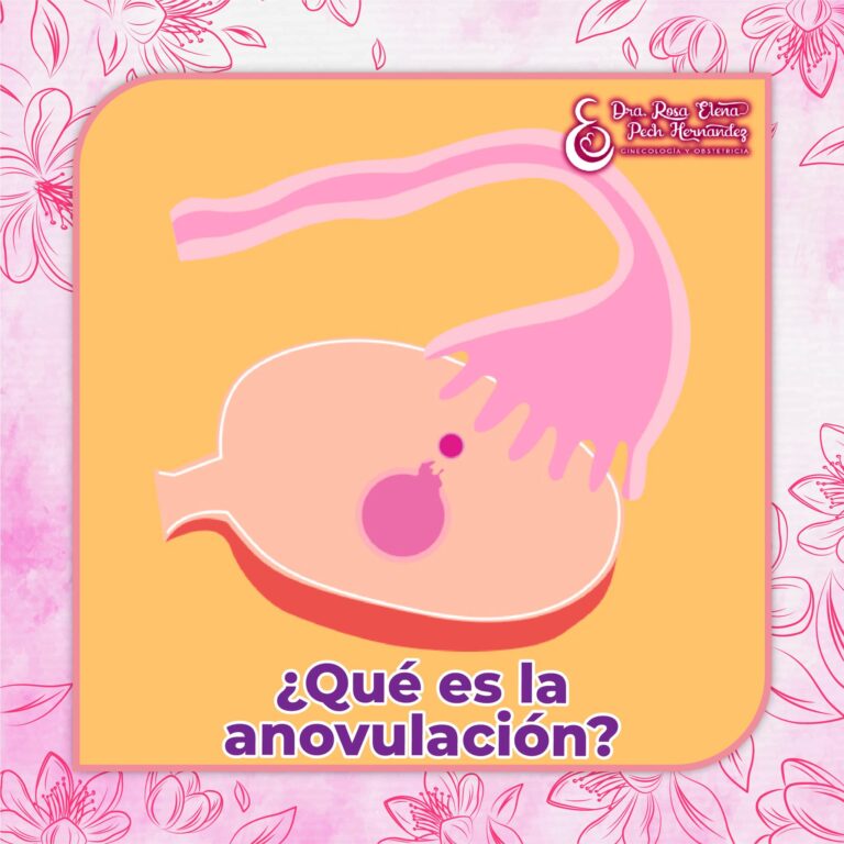 ¿Qué es la anovulación?