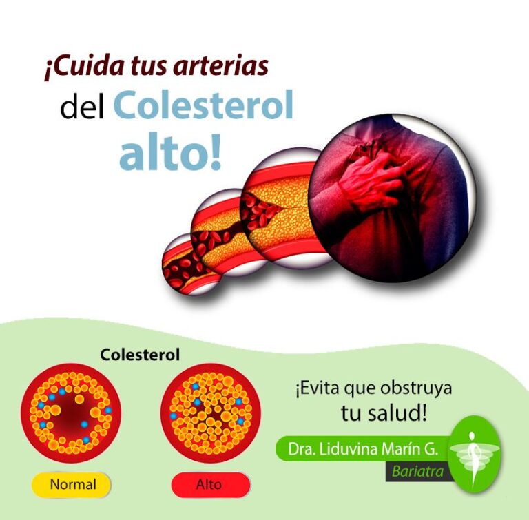 COLESTEROL ALTO