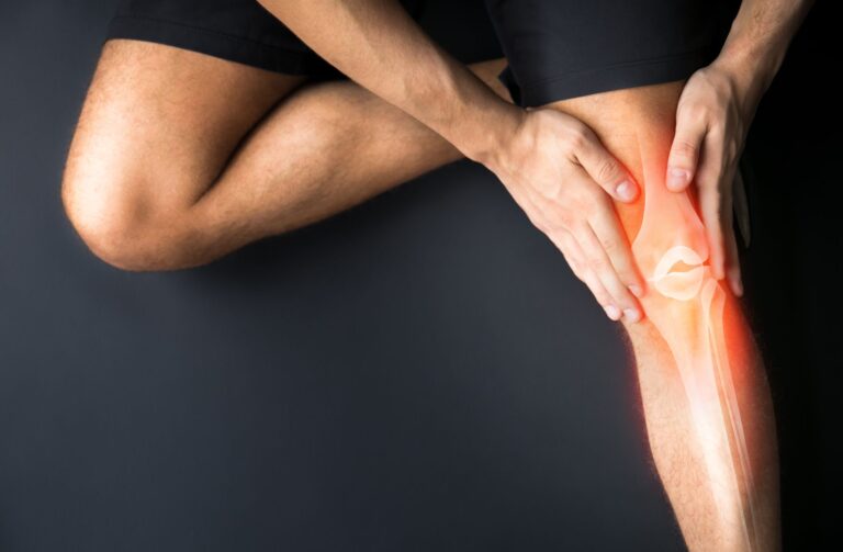 Las lesiones en el Crossfit… ¿verdad o mentira?