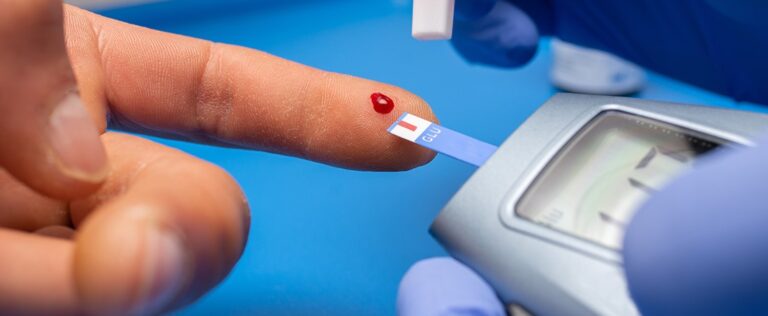 «Estadísticas Preocupantes: La Diabetes Mellitus Tipo II Entre las Principales Causas de Mortalidad en Yucatán»